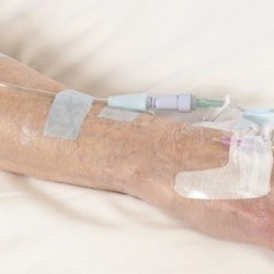 Medical silicone tapes