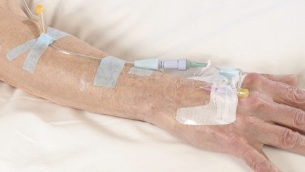 Medical silicone tapes