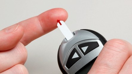 IVD test strips