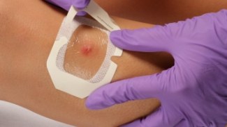 Single sided medical tapes